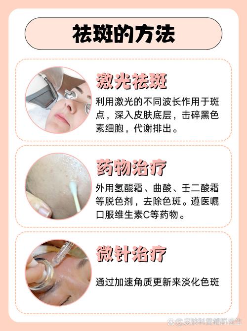 激光祛除黄褐斑安全吗