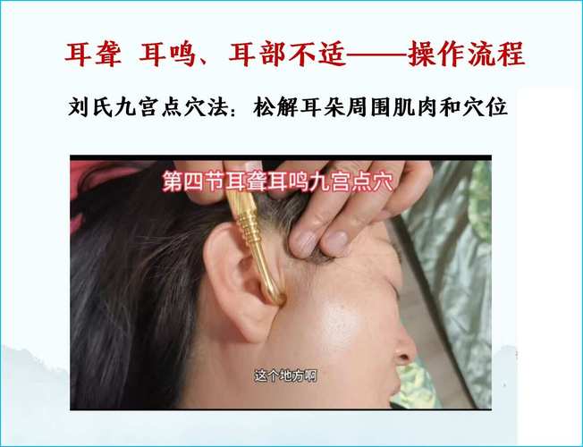 哈尔滨祖研针灸多少钱