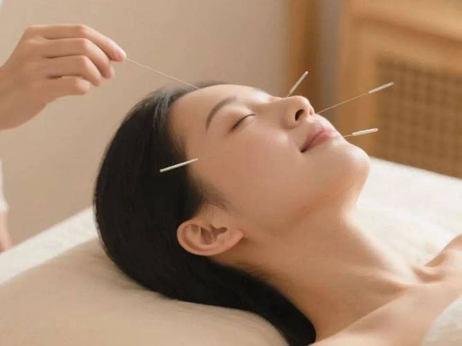 面部美容针灸扎的图片