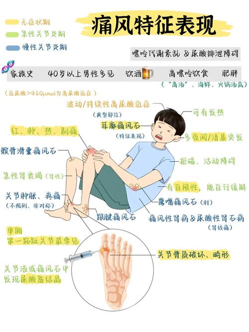 痛风会不会影响性生活