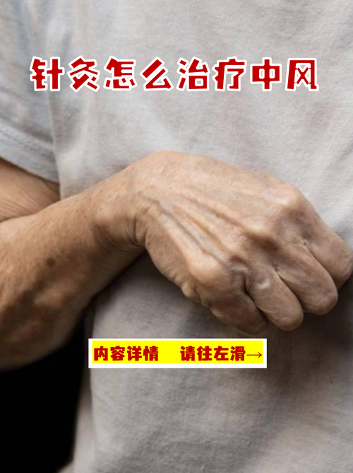 中风针灸多久可以恢复