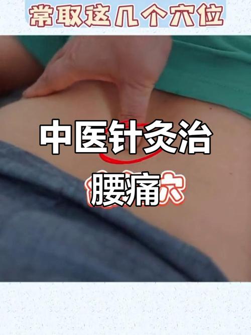 针灸治疗腰疼效果好吗