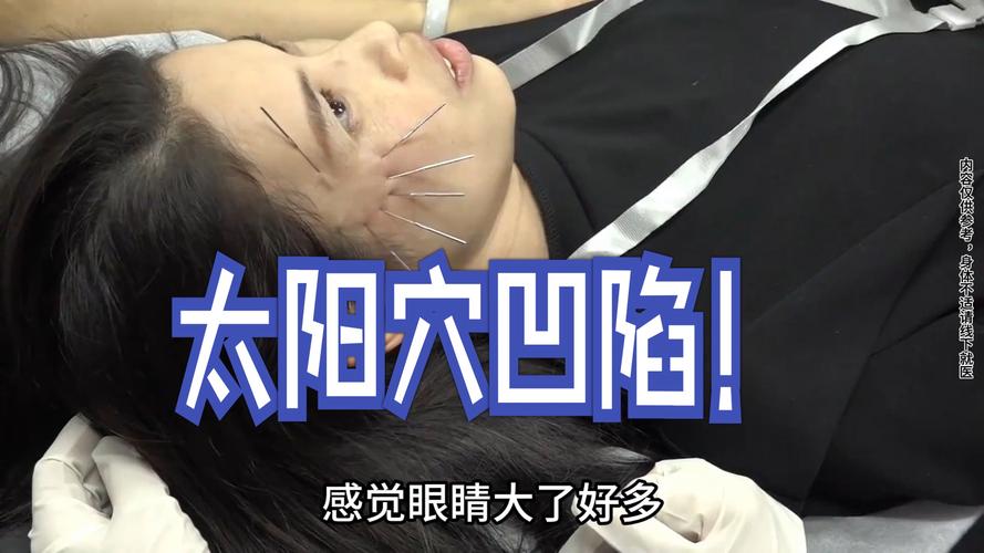 针灸美雕谁做过可靠吗