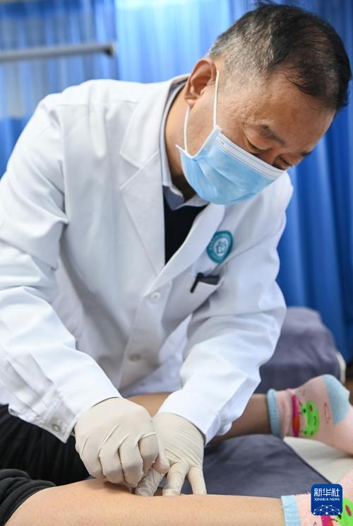 西安有名气的针灸医生