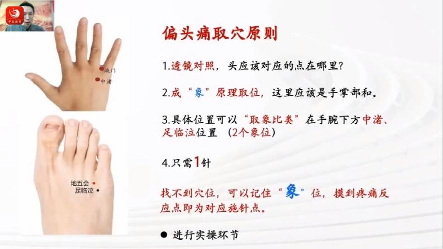 针灸后头痛是什么原因