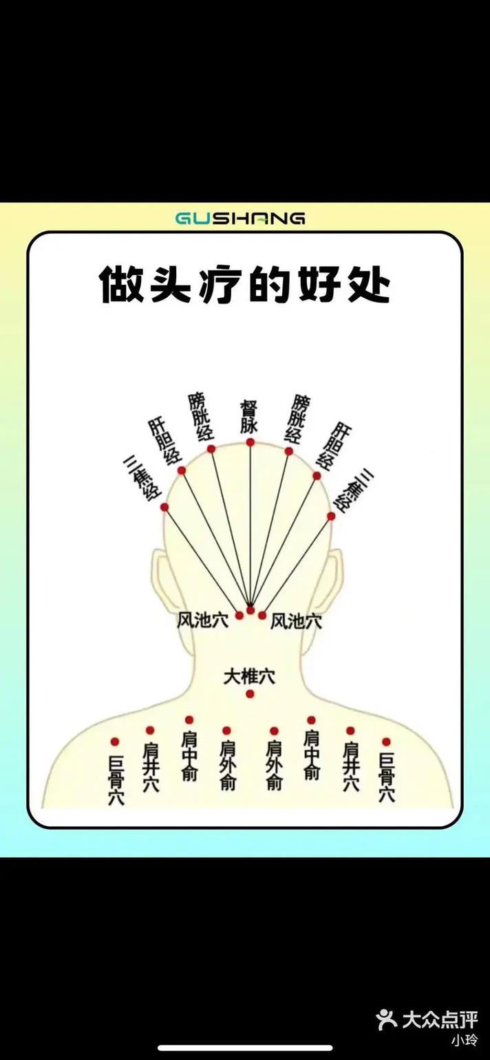 头部扎针灸起什么作用