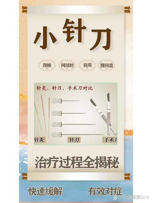 小刀针灸对身体有害吗
