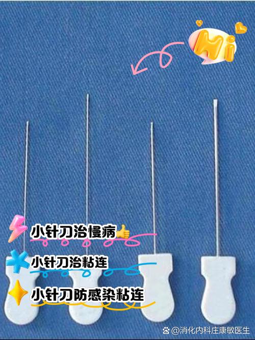 小刀针灸对身体有害吗