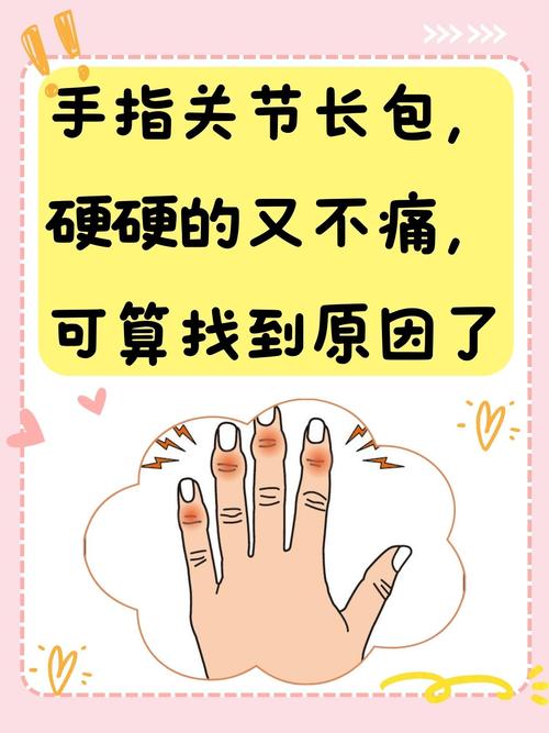 手指头关节痛是痛风吗