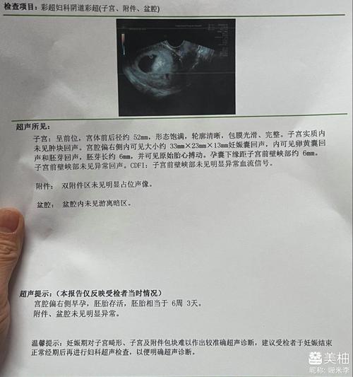 孕囊离切口多远才安全