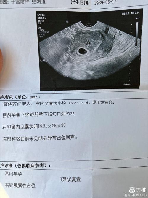 孕囊离切口多远才安全