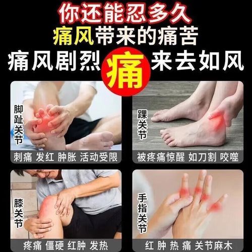 吃碳酸氢钠片治痛风吗