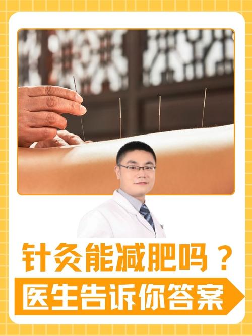 针灸减肥一月能瘦多少