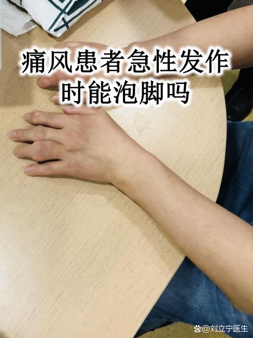 痛风可以用盐水泡脚吗