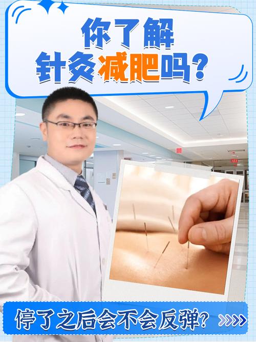 为什么针灸减肥会反弹