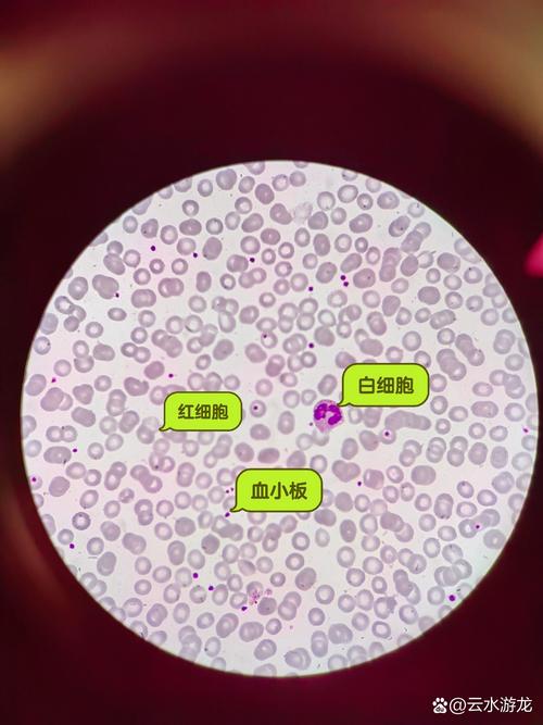 血液活细胞填充安全吗