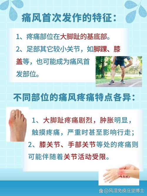 大脚趾痛一定是痛风吗