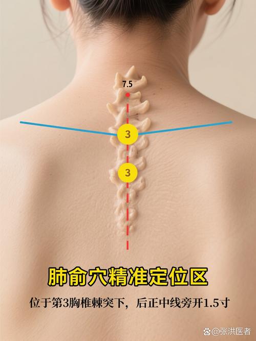 背部针灸几寸会扎到肺