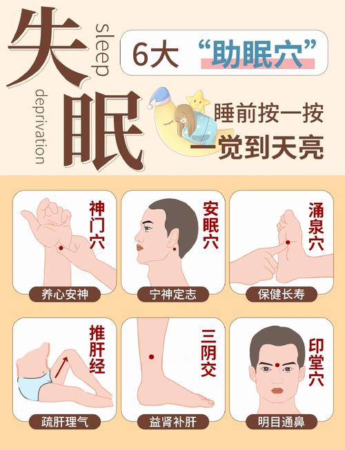 针灸多少天能治好失眠