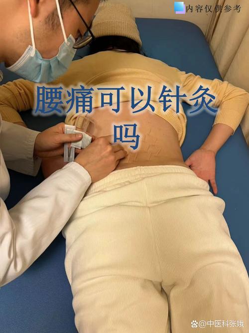 腰痛月经期可以针灸吗