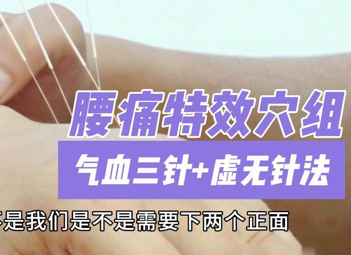 腰痛月经期可以针灸吗