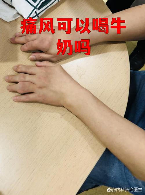 痛风可以喝营养快线吗
