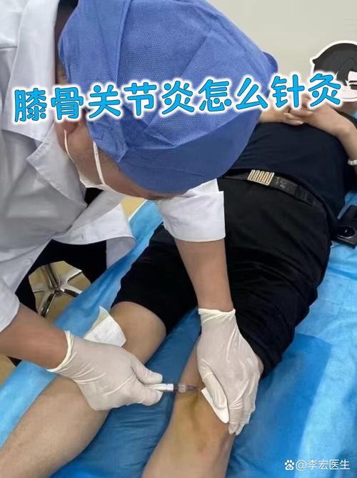 骨质增生能针灸治疗吗