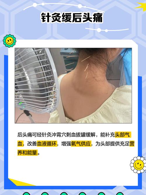 针灸对神经恢复有用吗