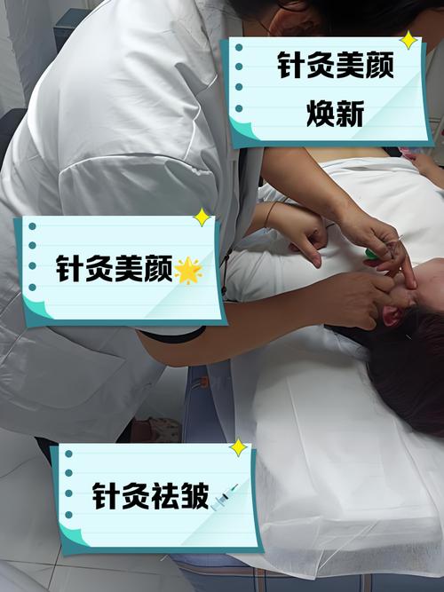 针灸面部提升有效果吗