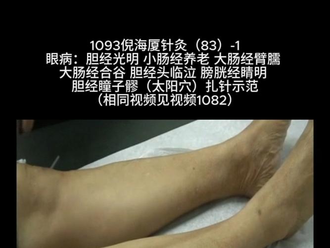 倪海厦针灸视频90集