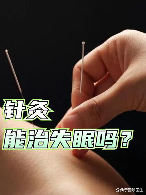 针灸治疗失眠多久见效