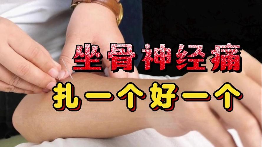 坐骨神经痛可以针灸吗