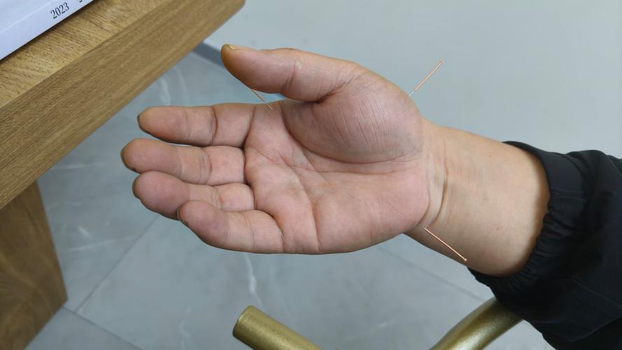 自己可以给自己针灸吗