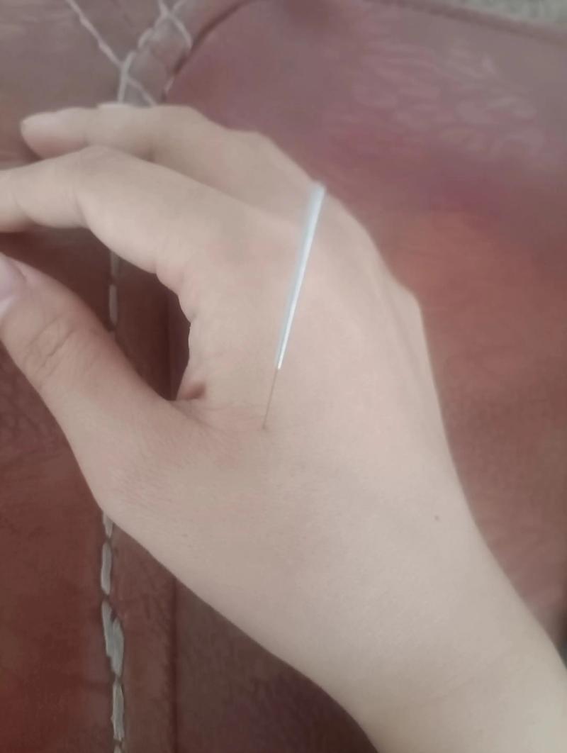 月经不调针灸哪个部位