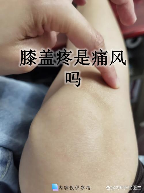 喝完酒膝盖疼是痛风吗