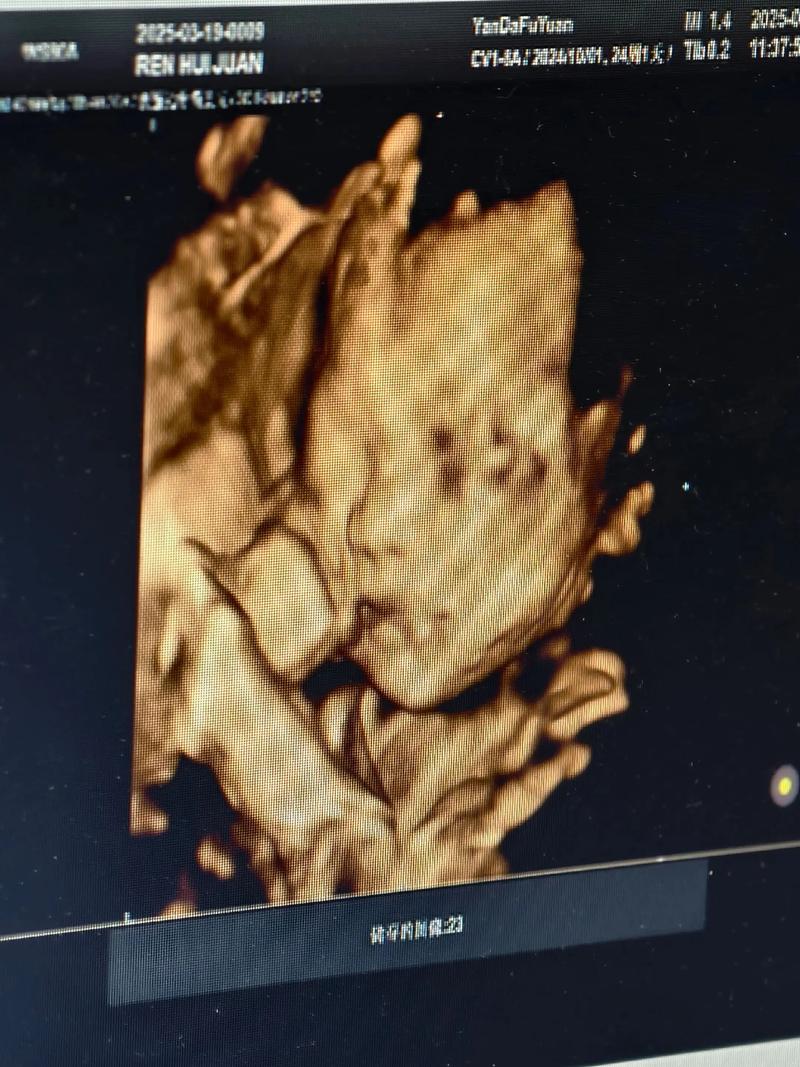 四维只看到侧脸安全吗