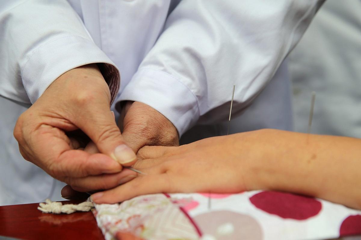 针灸治疗风湿性关节炎