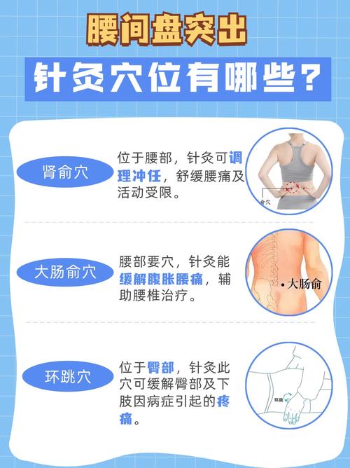 腰间盘突出针灸有用吗