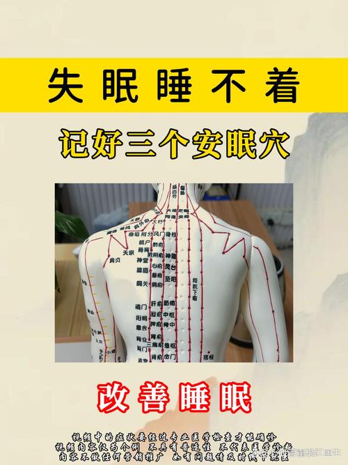 睡眠不好针灸哪些部位