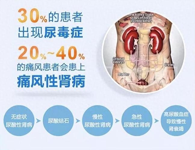 痛风肾上海明珠真不错