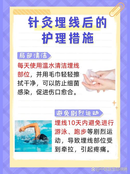 埋线和针灸哪个效果好