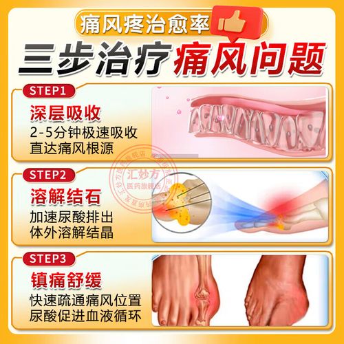 痛风吃什么药降尿酸快