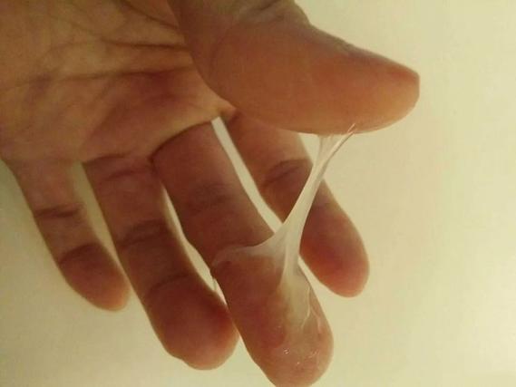 妇科针灸后白带水样