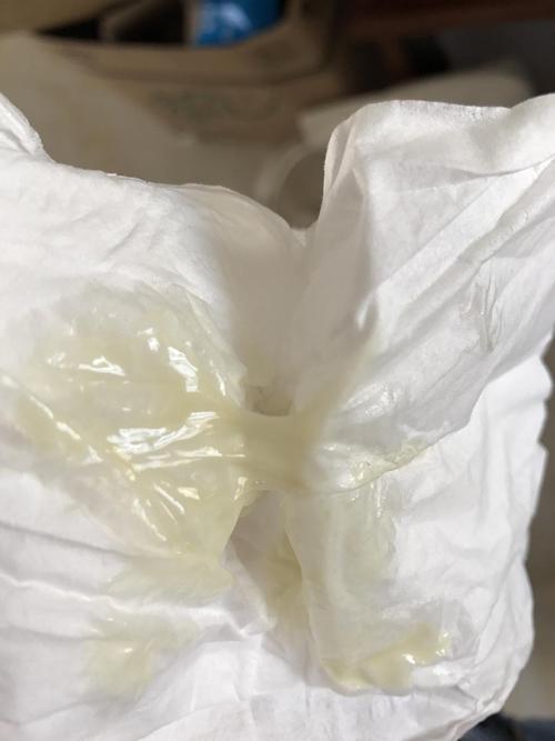 妇科针灸后白带水样