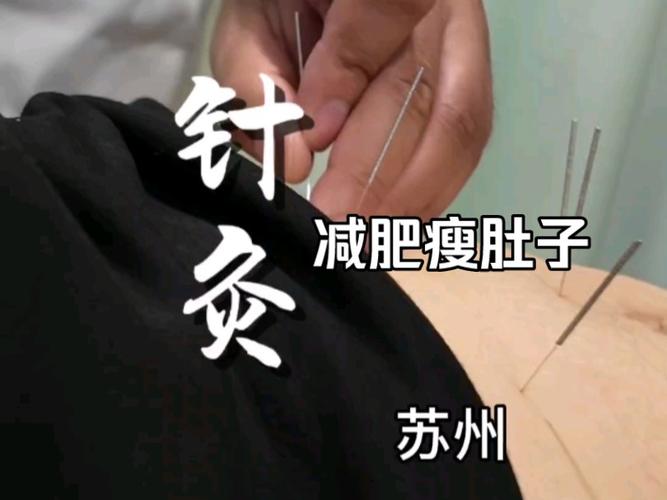 肚子上针灸脉冲减肥