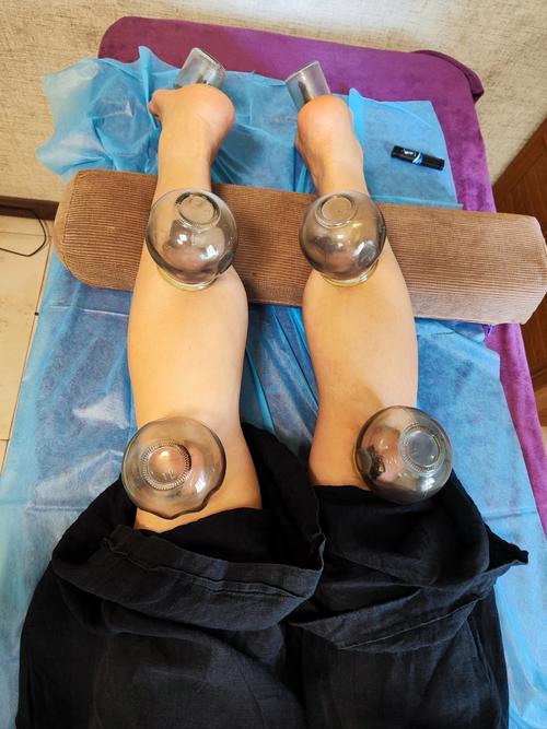 腿部针灸减肥有效吗