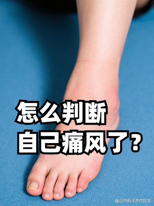 痛风最先的症状是什么