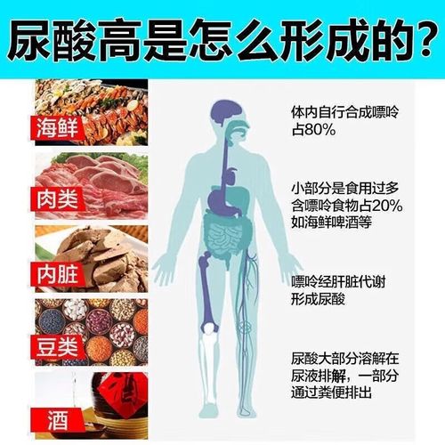 痛风小苏打怎么吃最好
