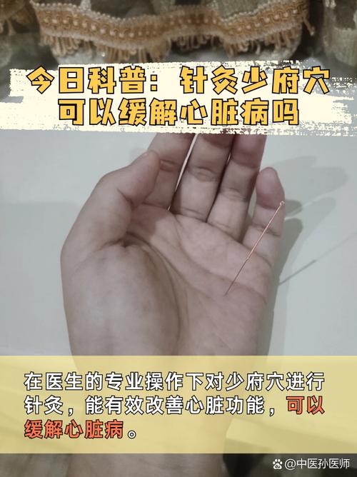 针灸可以治疗胸闷吗