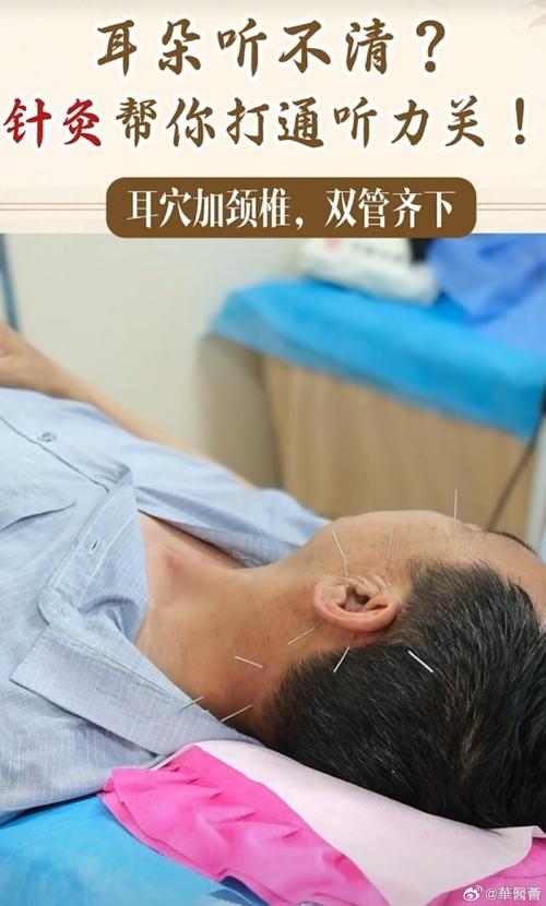 耳鸣能用针灸治疗时